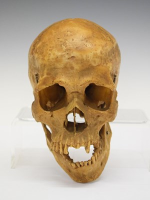 Lot 335 - Medical resin model of a human skull