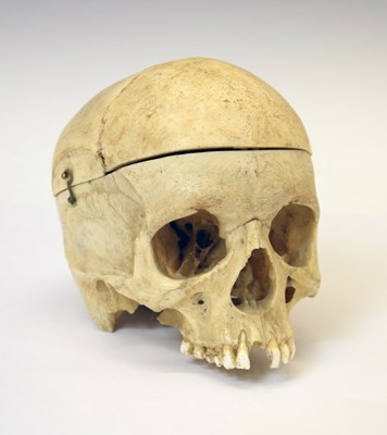 Lot 347 - Medical School instructional human skull